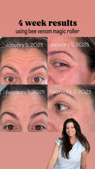 Real Results 

Proven Results

No Filter

No Edits

Consistency 

Save with my code: Jenhayes10
When you shop www.wildflowerplantmagic.com
All products linked in my @campsite.bio page but if you’d like any links sent to you directly just comment below.

Feed Your Skin What It Loves-Naturally!

#jenhayesbeautytips #beevenomworks #beevenom #noninvasive #wrinkles