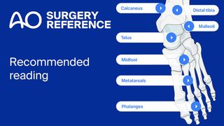 📚 New in the series of Recommended Reading: Foot and Ankle Trauma and Reconstruction

Enhance your learning and teaching experience with our newly released AO Surgery Reference link collection for Foot and Ankle Trauma and Reconstruction courses.

✅ Carefully selected resources complementing course material and supporting continuous learning in daily practice
✅ Expert-reviewed guidance helping resident to build confidence in managing foot and ankle injuries
✅ Introductory section with links to basic techniques and compartment syndrome.

Whether you are preparing for an upcoming course, teaching a module, or looking to deepen your understanding of foot and ankle trauma and reconstruction, the Recommended Reading page helps you find relevant resources in one place.

🔗 Explore the Recommended Reading page:
https://surgeryreference.aofoundation.org/orthopedic-trauma/adult-trauma/curriculum/foot-and-ankle-trauma-reconstruction

📅 Find upcoming Foot & Ankle Trauma and Reconstruction courses:
https://www.aofoundation.org/trauma/search-results?q=foot#f-specialty=AO+Trauma&f-type=Educational+Event

#AOTrauma #AOSurgeryReference #FootAndAnkle #OrthopedicTrauma #MedicalEducation #LifelongLearning #AOFoundation